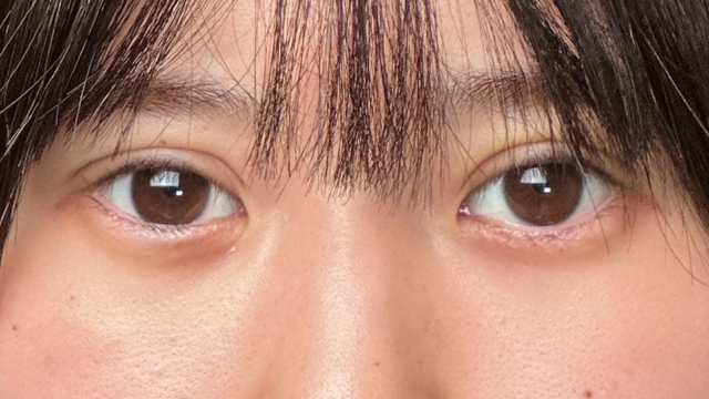 Postoperative Condition Part 1