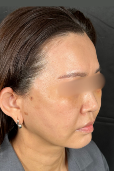 Postoperative Condition Part 1