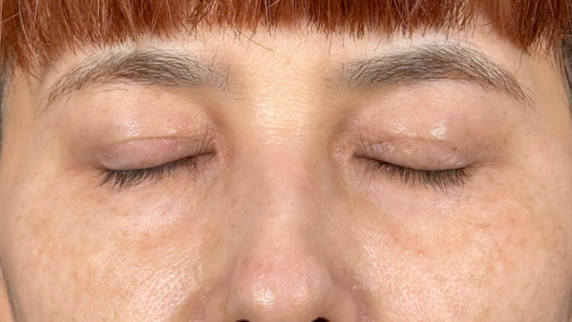 Postoperative Condition Part 1