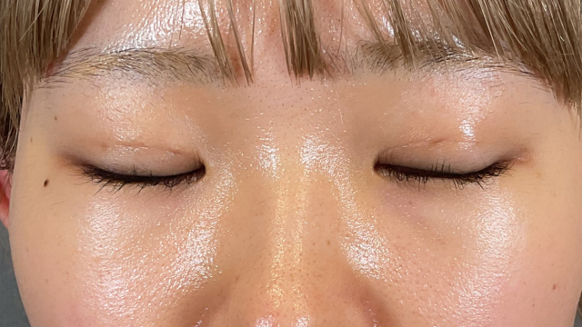 Postoperative Condition Part 1