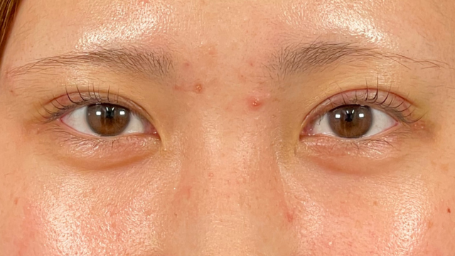 Postoperative Condition Part 1