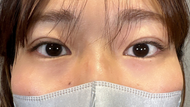 Postoperative Condition Part 1