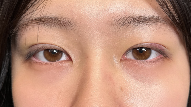 Postoperative Condition Part 1