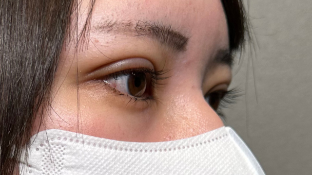 Postoperative Condition Part 1