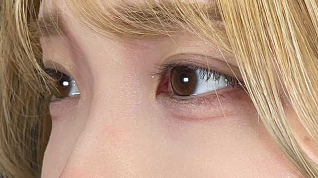 Postoperative Condition Part 1