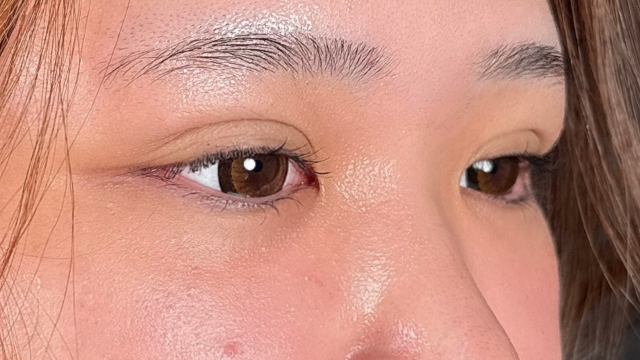 Postoperative Condition Part 1