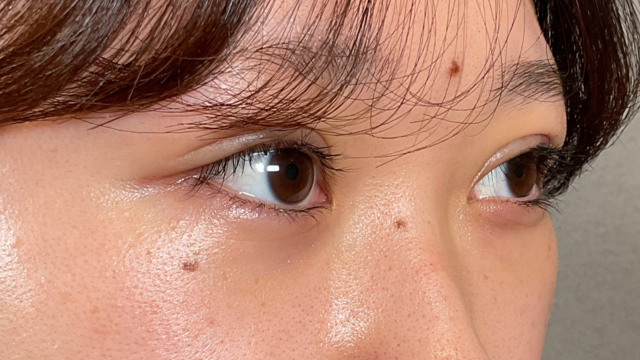 Postoperative Condition Part 1