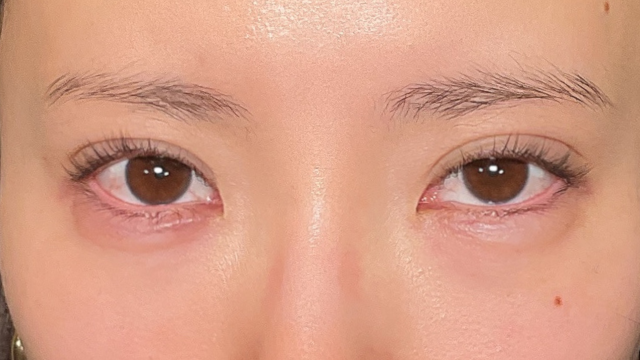 Postoperative Condition Part 1