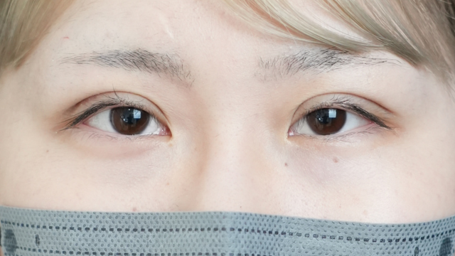 Postoperative Condition Part 1