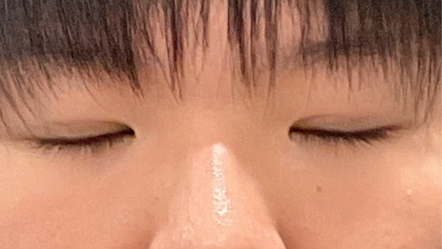 Postoperative Condition Part 1