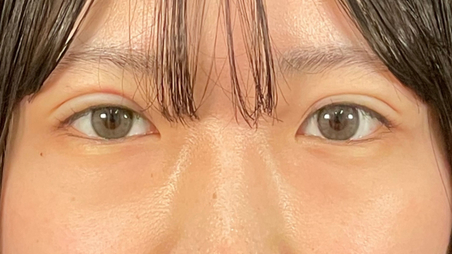 Postoperative Condition Part 1