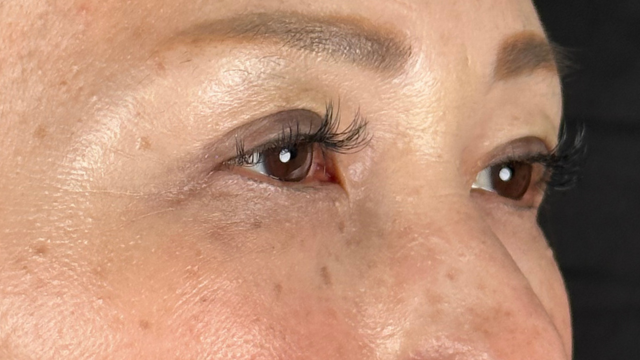 Postoperative Condition Part 1