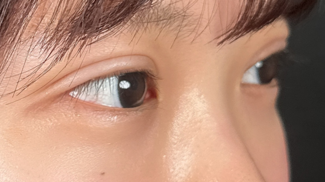 Postoperative Condition Part 1