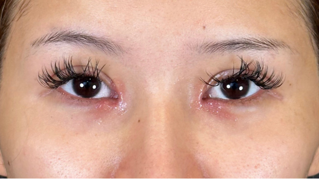 Postoperative Condition Part 1