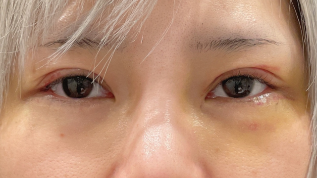 Postoperative Condition Part 1