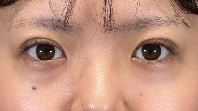 Postoperative Condition Part 1