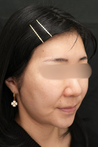 Postoperative Condition Part 1