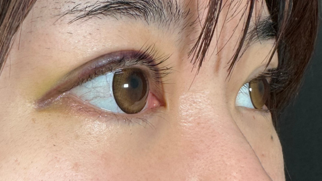 Postoperative Condition Part 1