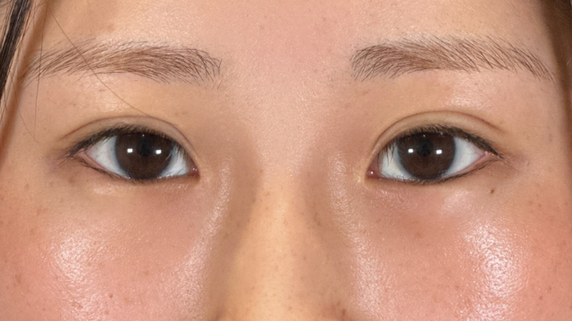 Postoperative Condition Part 1