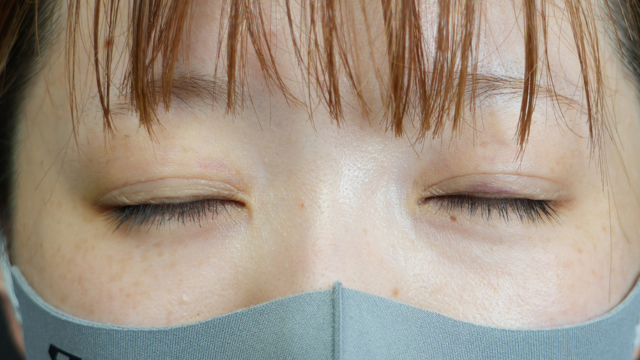 Postoperative Condition Part 1