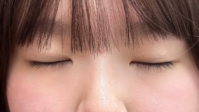 Postoperative Condition Part 1