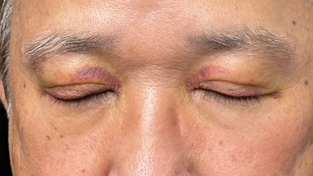 Postoperative Condition Part 1