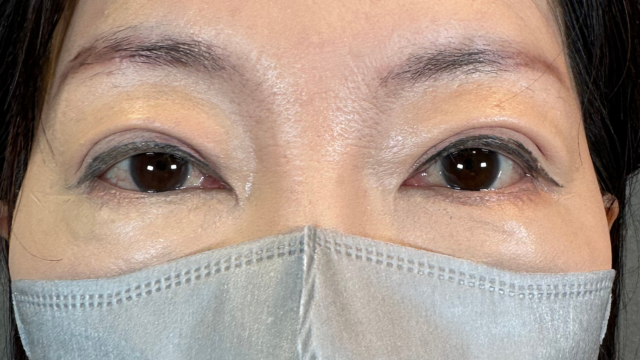 Postoperative Condition Part 1