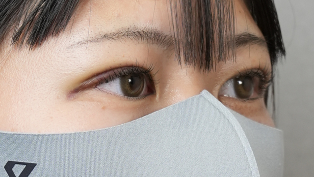 Postoperative Condition Part 1