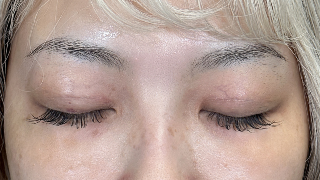 Postoperative Condition Part 1