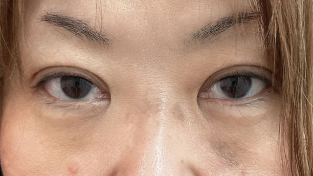 Postoperative Condition Part 1