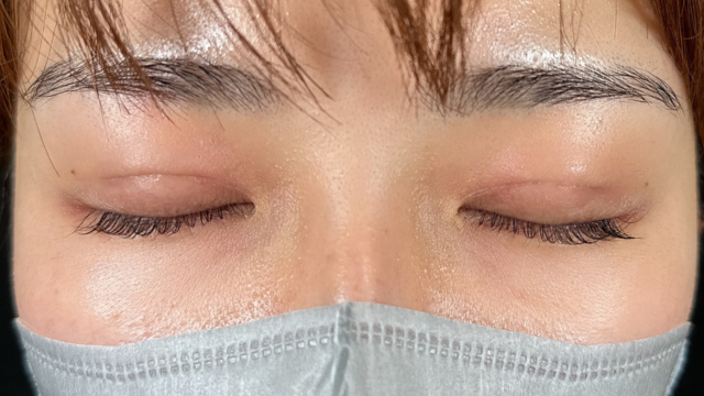 Postoperative Condition Part 1