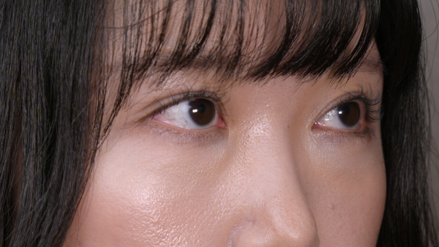 Postoperative Condition Part 1