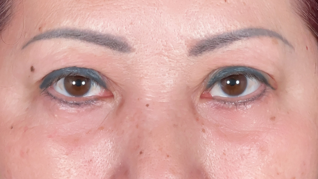 Postoperative Condition Part 1