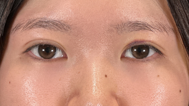 Postoperative Condition Part 1