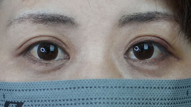 Postoperative Condition Part 1