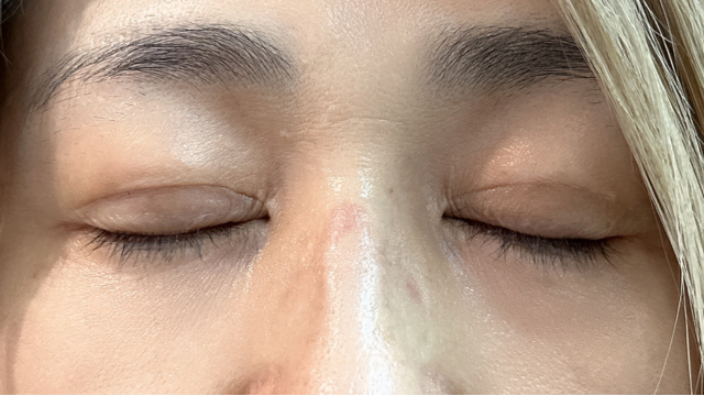 Postoperative Condition Part 1