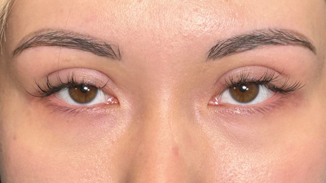 Postoperative Condition Part 1