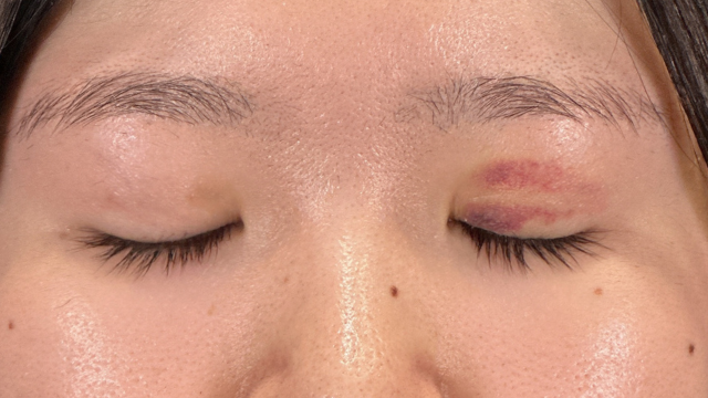 Postoperative Condition Part 1