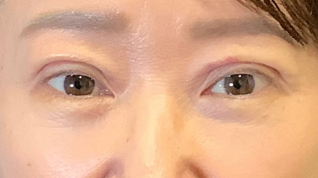 Postoperative Condition Part 1