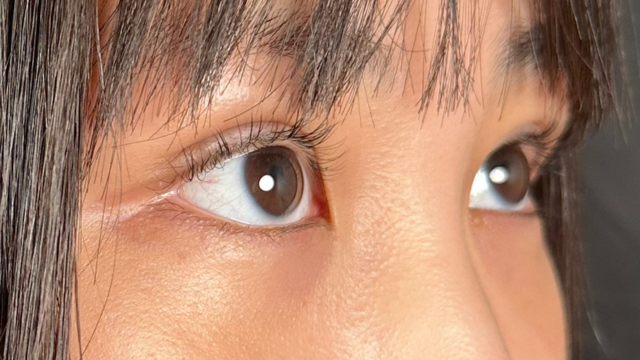 Postoperative Condition Part 1