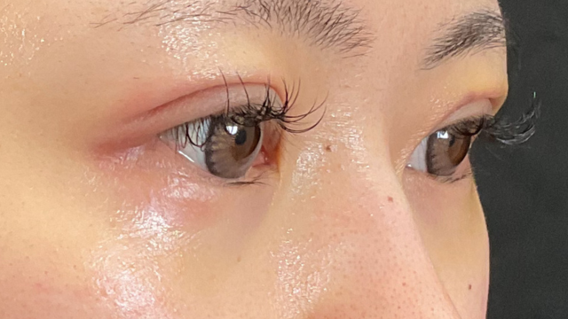 Postoperative Condition Part 1