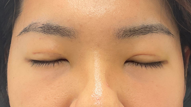 Postoperative Condition Part 1