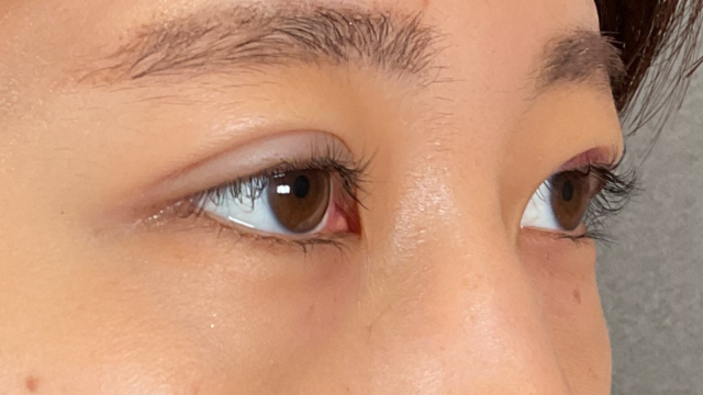 Postoperative Condition Part 1