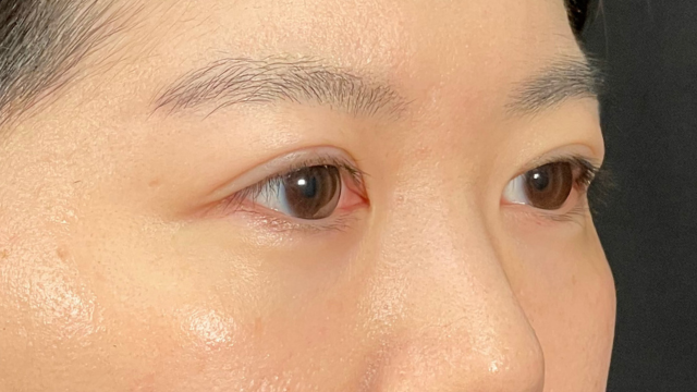 Postoperative Condition Part 1