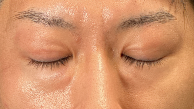 Postoperative Condition Part 1