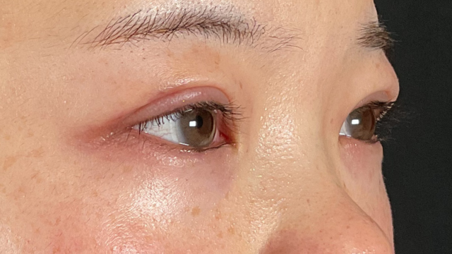 Postoperative Condition Part 1