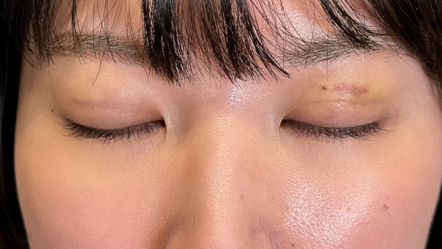 Postoperative Condition Part 1