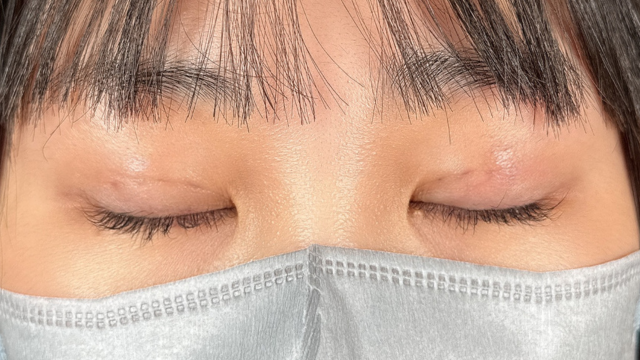 Postoperative Condition Part 1