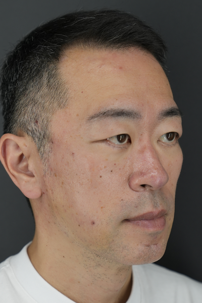 Postoperative Condition Part 1