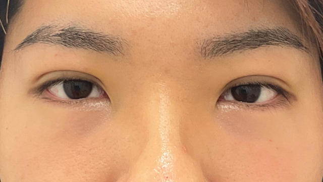 Postoperative Condition Part 1